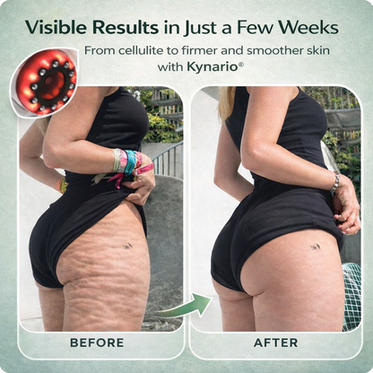 Kynario™ Triple Sculpt Technology